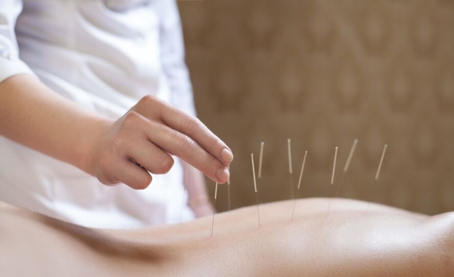 Akupuncture