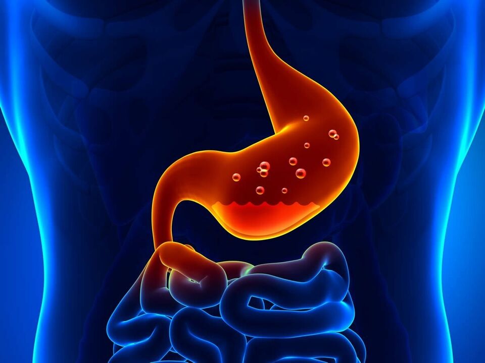 Gastritis ass eng entzündlech Krankheet vum Magen, déi Diät erfuerdert